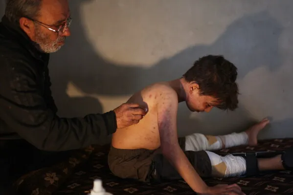 طفل مصاب يجلس على سرير، بينما يقوم رجل مسن بمعالجته. تظهر آثار الجروح على جسده، مع ضمادات على ساقيه.