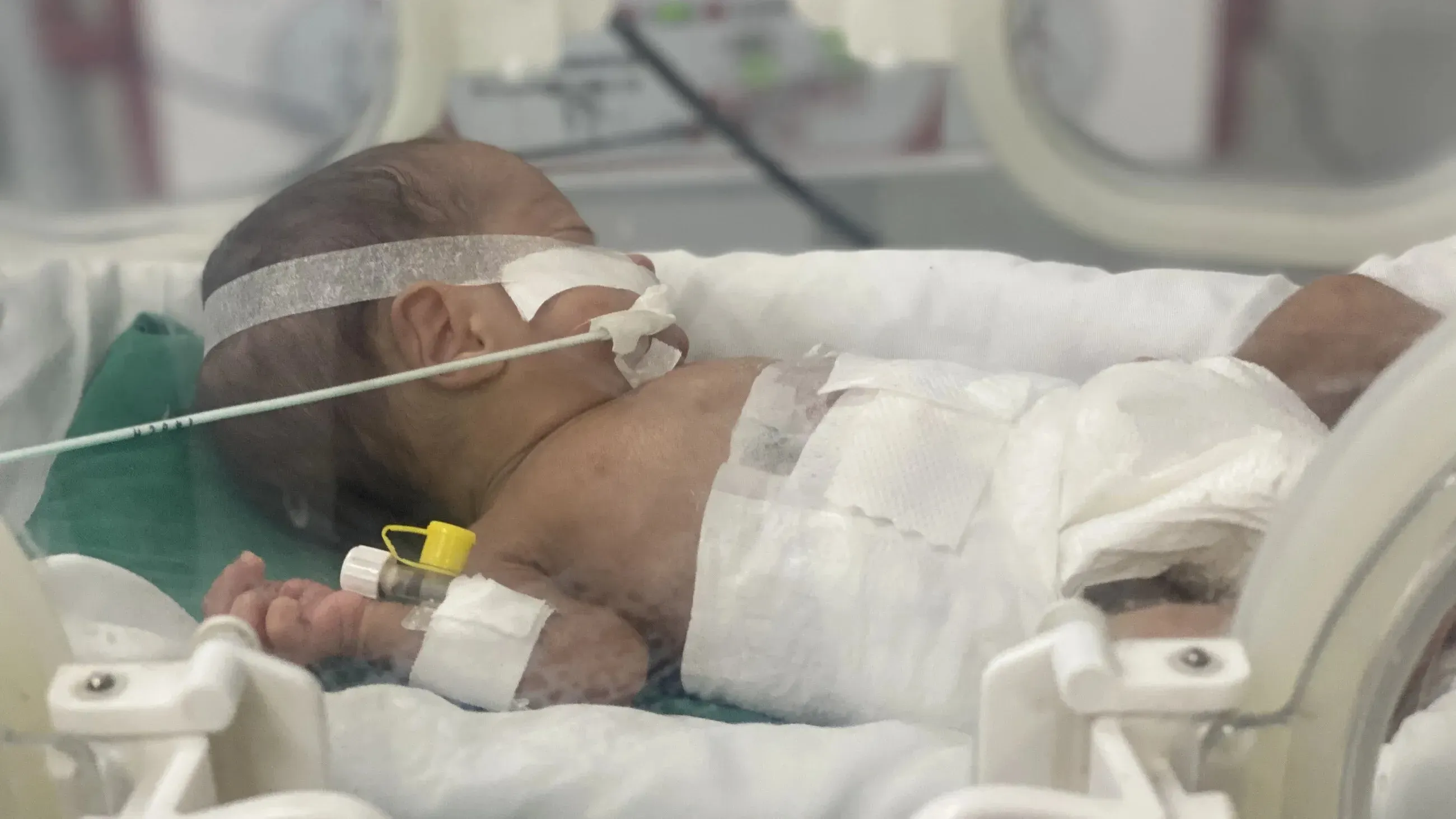 طفل رضيع في وحدة العناية المركزة بغزة، يتلقى العلاج في حاضنة، مع أنابيب أكسجين، وسط نقص حاد في الوقود يؤثر على الخدمات الصحية.