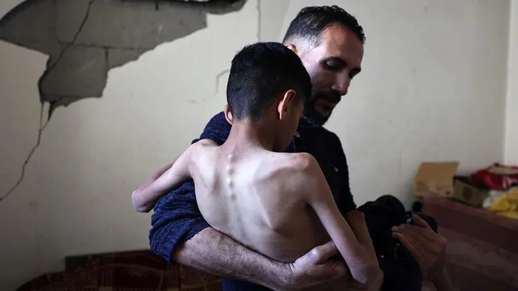 رجل يحمل طفلاً نحيفاً في غرفة تتسم بالخراب، يعكس معاناة الجوع وسوء التغذية في غزة خلال الأزمات الإنسانية.