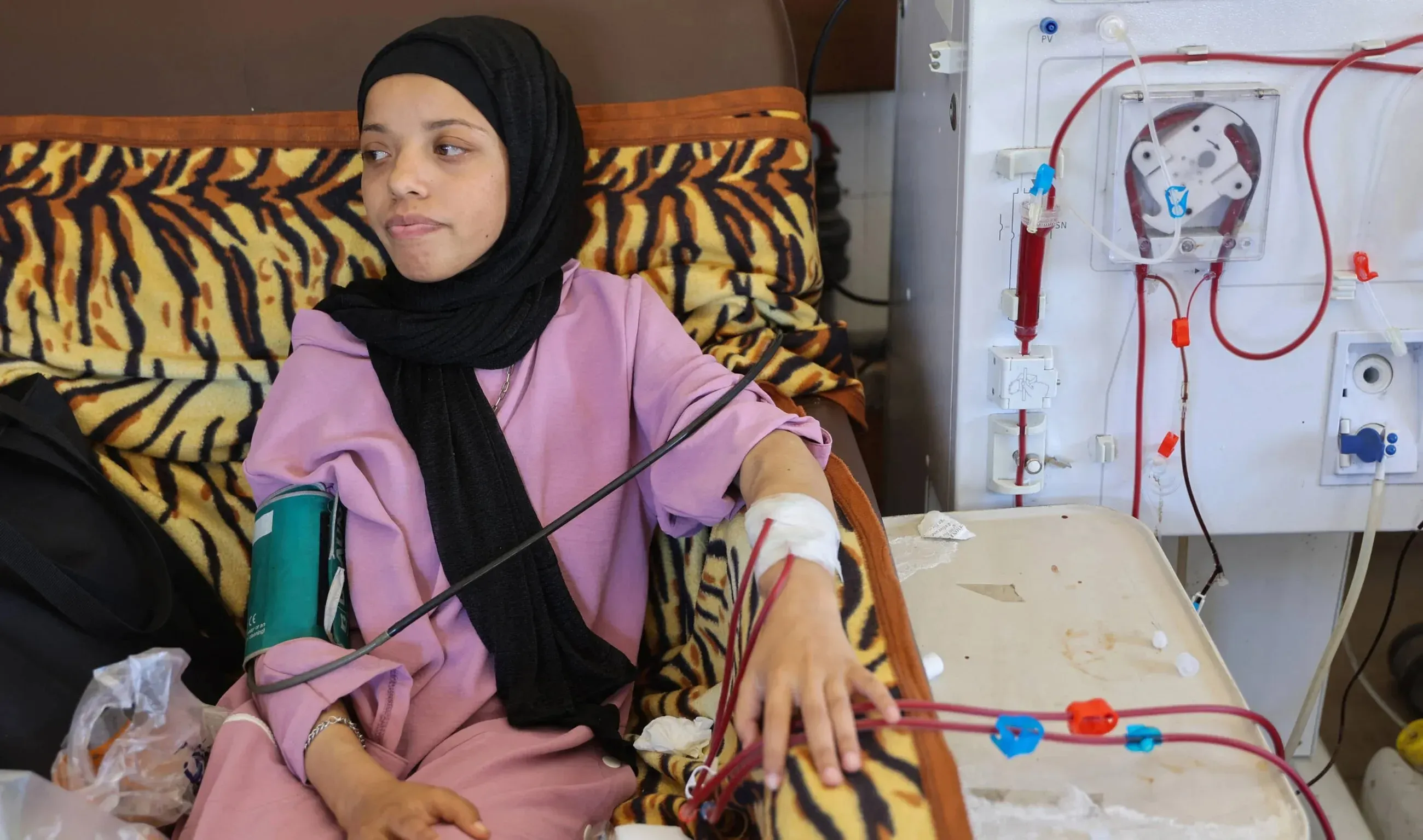 فتاة شابة تتلقى جلسة غسيل كلى في مستشفى الشفاء بغزة، حيث تعاني من نقص حاد في الوقود والمياه، مما يهدد حياتها وصحة المرضى الآخرين.