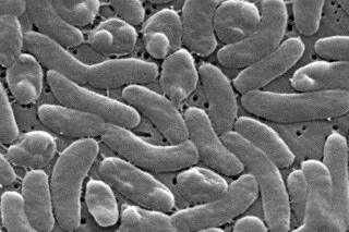 بكتيريا آكلة للحوم Vibrio vulnificus تحت المجهر الإلكتروني تظهر شكلها العصوي المرتبط بزيادة الإصابات في مياه لويزيانا الساحلية.