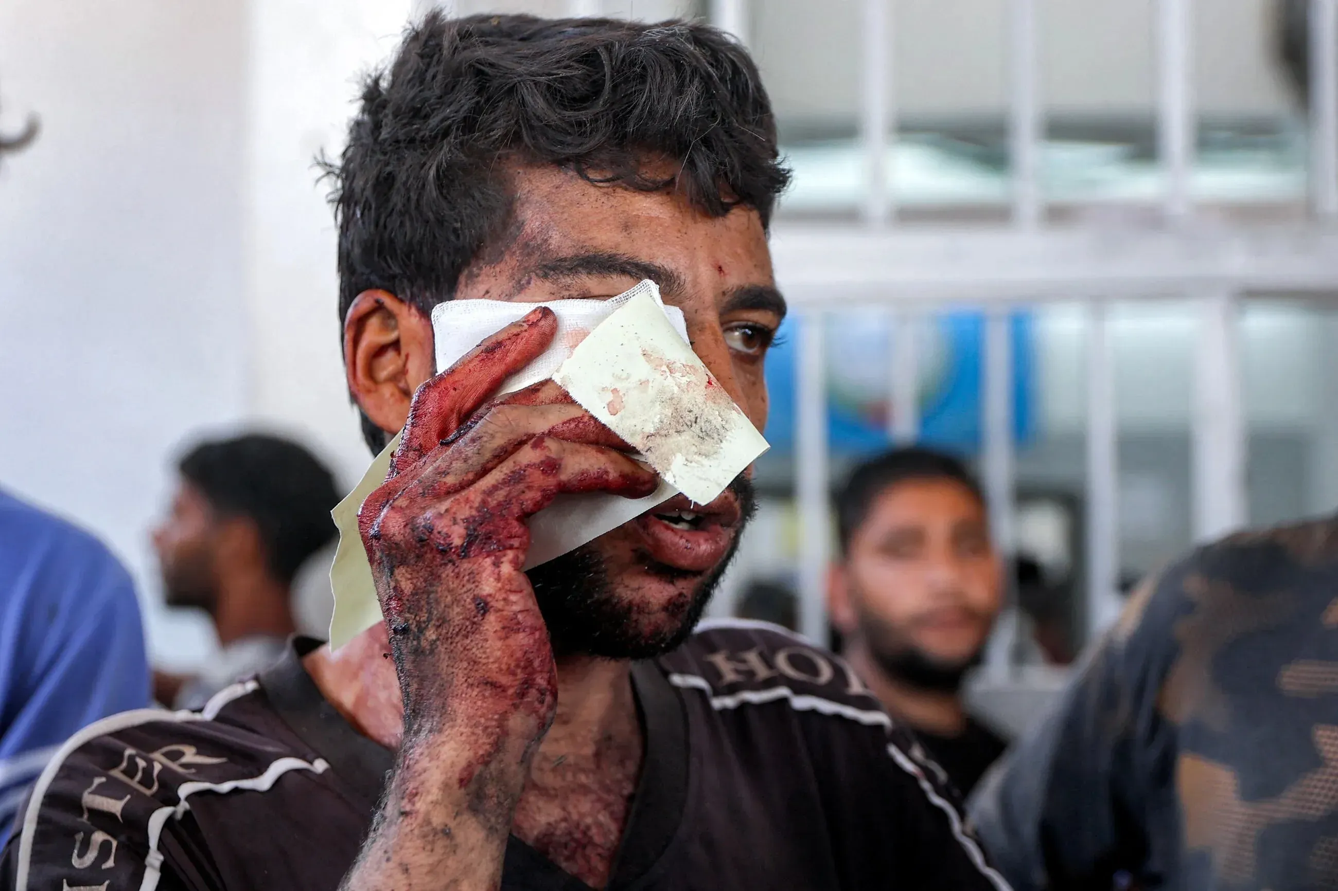 شخص مصاب بجروح خطيرة، يضع ضمادة على وجهه الملطخ بالدماء، في مركز طبي بغزة، وسط أجواء من الألم والمعاناة الإنسانية.