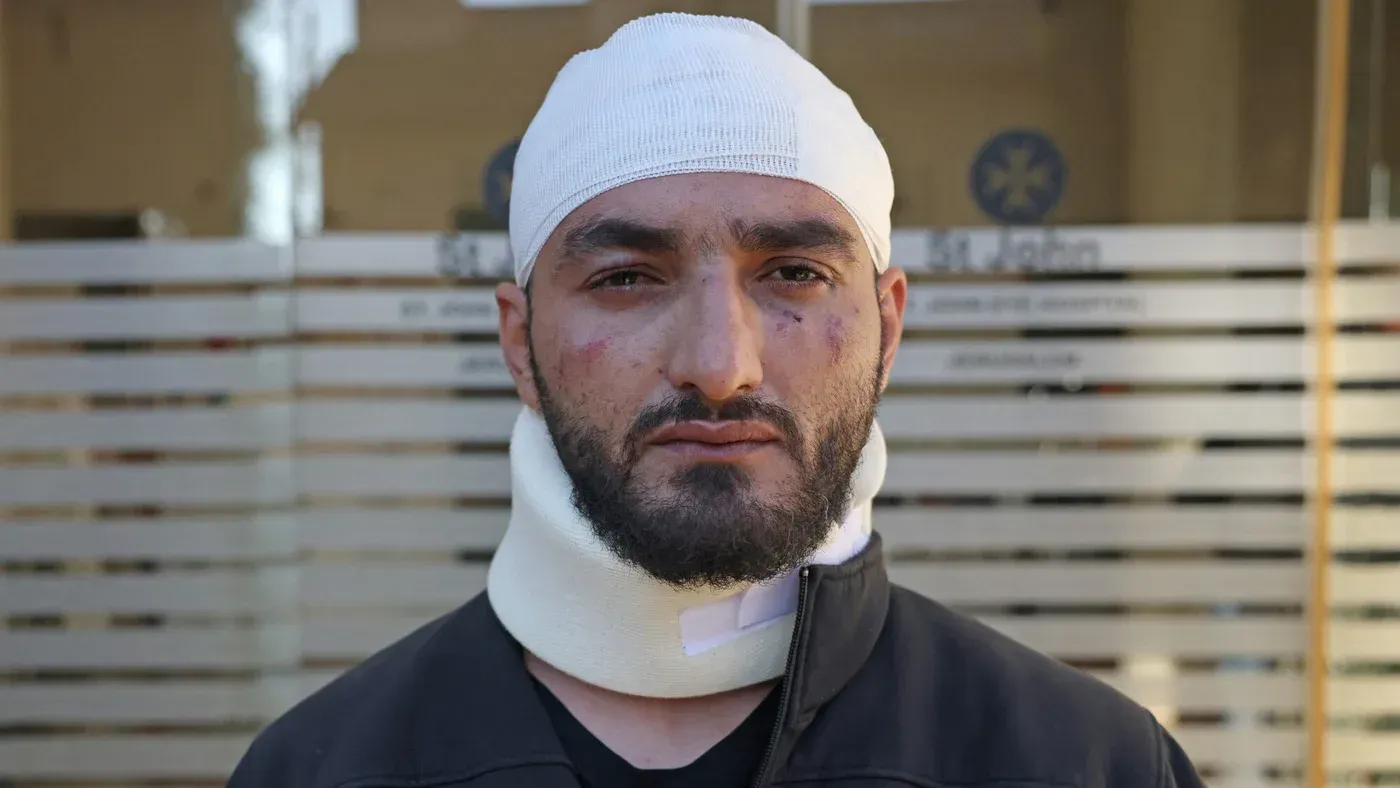 مصطفى الخاروف، مصور صحفي فلسطيني، يظهر بجروح على وجهه ورقبته بعد اعتداء ضابط إسرائيلي عليه أثناء تغطيته للأحداث في القدس.