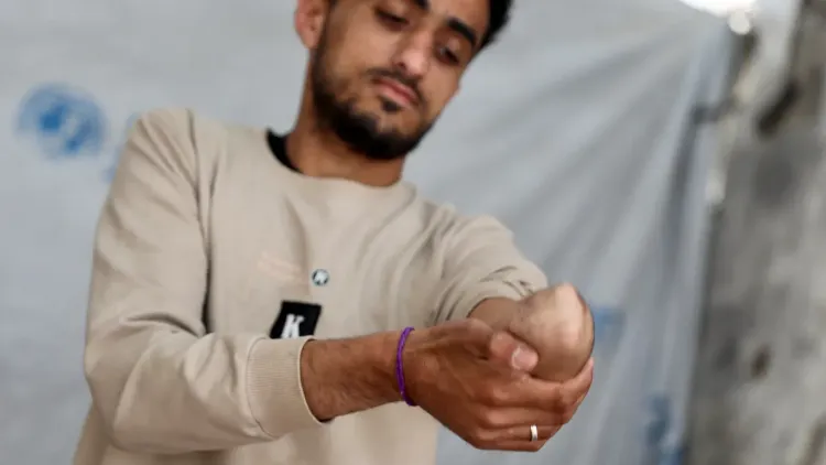 شاب فلسطيني يظهر جرحه في ذراعه بعد فقدان يده جراء القصف الإسرائيلي، مع خلفية تعكس آثار الدمار في غزة.