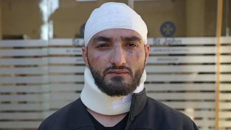 مصطفى الخاروف، مصور صحفي فلسطيني، يظهر بجروح على وجهه ورقبته بعد اعتداء ضابط إسرائيلي عليه أثناء تغطيته للأحداث في القدس.