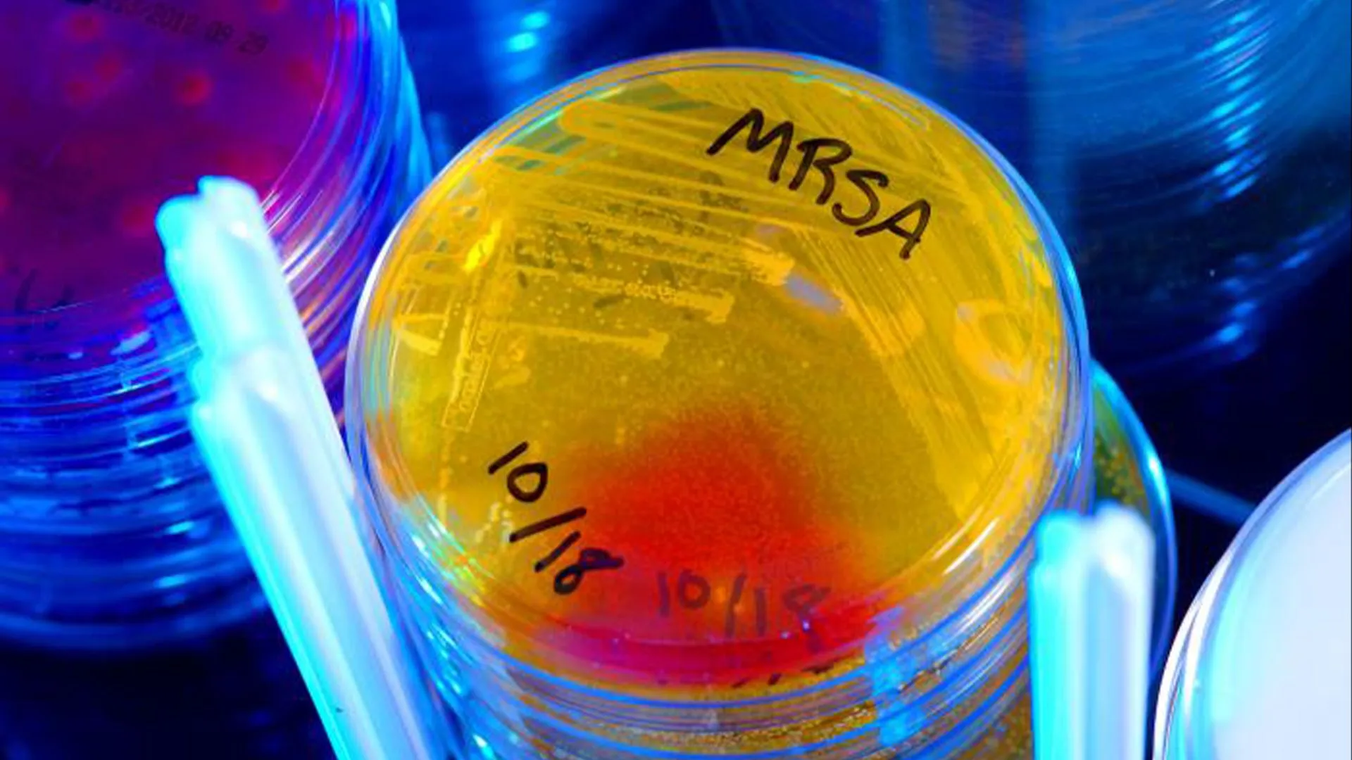 أطباق بتري مزروعة ببكتيريا MRSA المقاومة للمضادات الحيوية، توضح تحديات مقاومة المضادات الحيوية وتأثير التزييف على وصف الأدوية.
