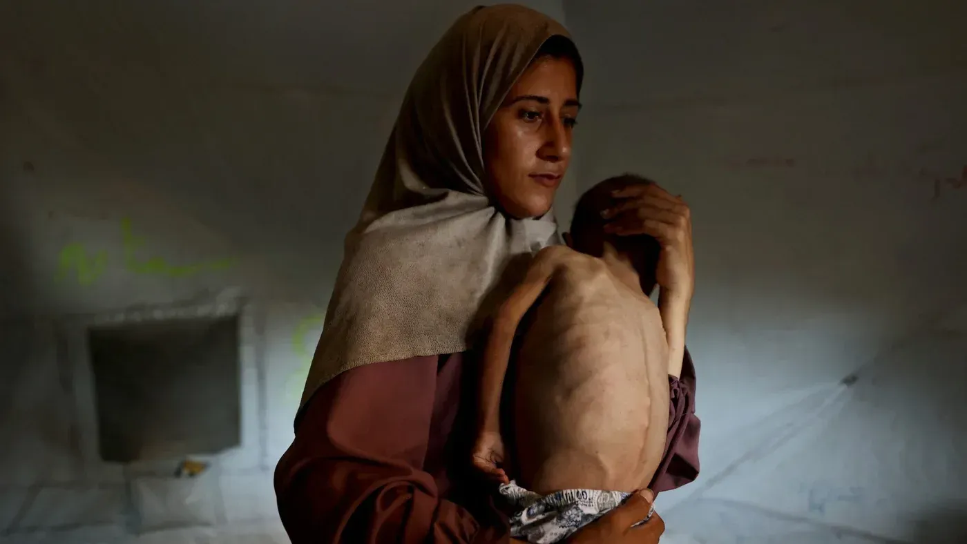 امرأة تحمل طفلًا نحيفًا جدًا يعاني من سوء التغذية في غزة، مما يعكس تأثير الحصار على الأطفال في المنطقة.