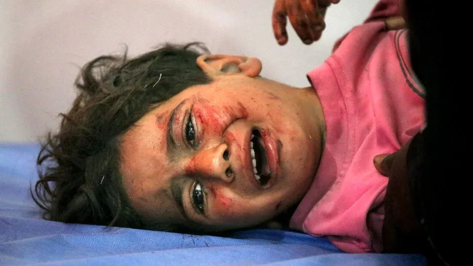 طفل فلسطيني يبكي مصاب بجروح على وجهه، يعكس تأثيرات العنف في قطاع غزة وسط تقارير أممية عن استهداف الأطفال.