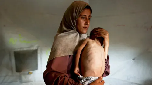 امرأة فلسطينية تحمل طفلًا نحيفًا يعاني من سوء التغذية في خيمة، تعكس الأوضاع الإنسانية الصعبة في غزة بسبب المجاعة المستمرة.