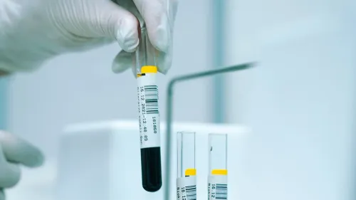 أنابيب اختبار دم تحمل عينات لفحص العلامات الحيوية المرتبطة بمرض الزهايمر مثل p-tau181 وGFAP في مختبر طبي.
