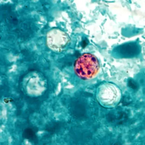 تكبير مجهر لطفيلي Cyclospora في عينة براز، يظهر تفاصيل الطفيلي المسبب لتفشي وبائي في الولايات المتحدة عام 2026.