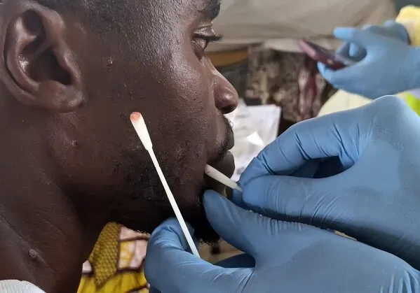 رجل يتلقى اختبارًا طبيًا في الكونغو، مع التركيز على عينة مأخوذة من جلده، في ظل تحديات استجابة تفشي الأمراض.